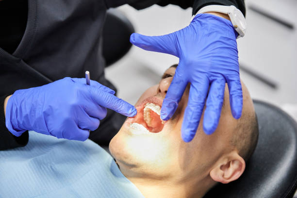 Best Tooth Infection Emergency Dentist  in Rosedale, WA